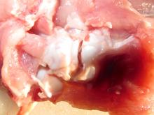 bone joint