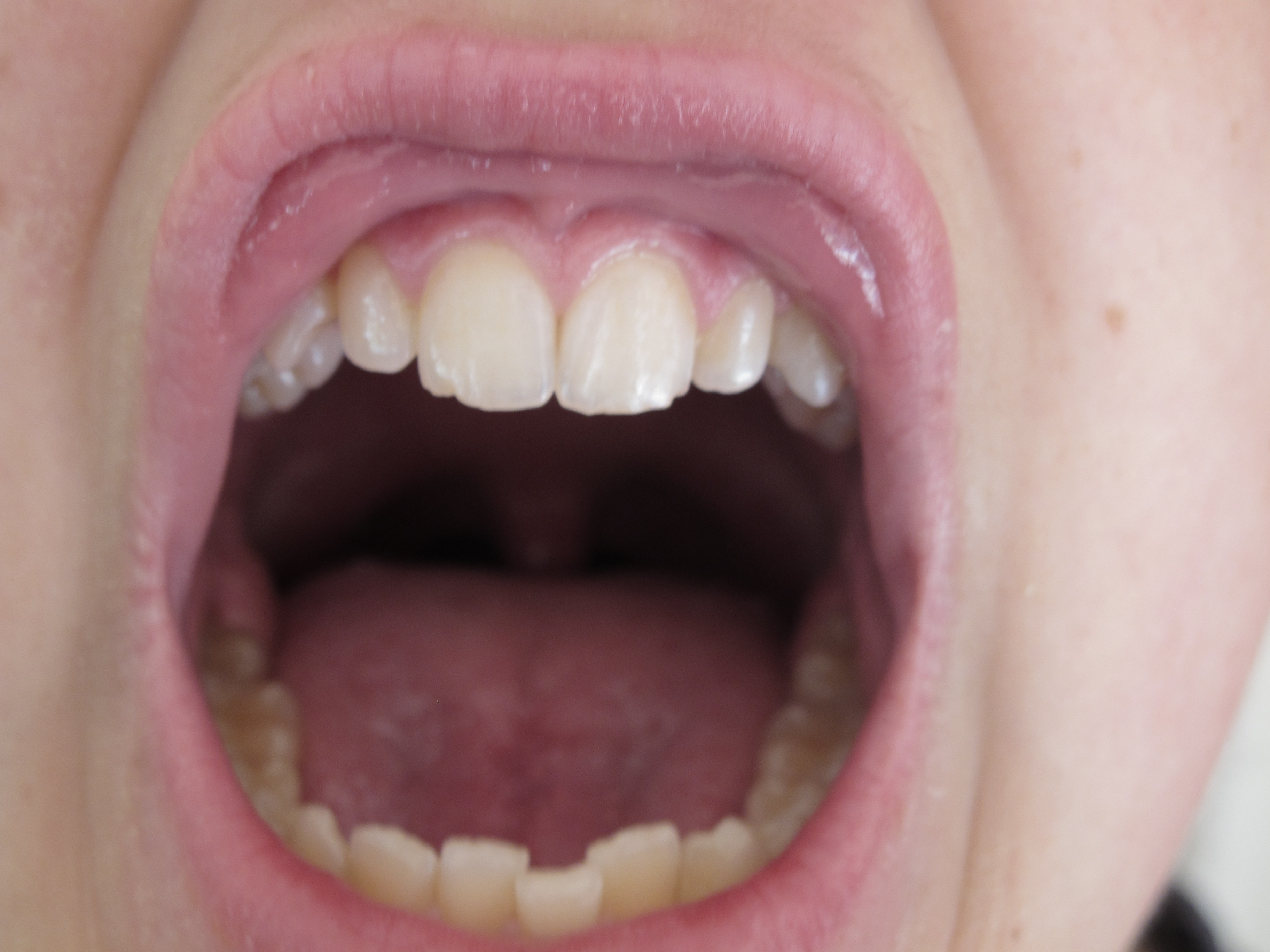 Get Herbivores Animals Teeth Images Pictures