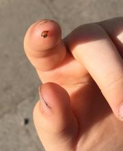 Worm egg
