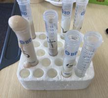 Tubes after 5 mins