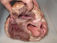 aorta with thick white/pink walls takes blood to the body
