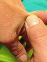 stretchy molecules: skin