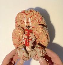 Vervor brain model